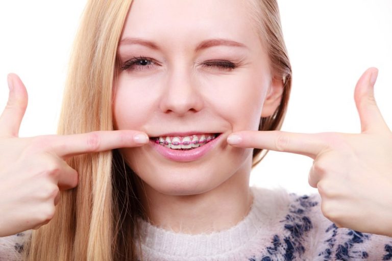 What Is The Best Age To Get Braces? - Tips On Braces & Orthodontics